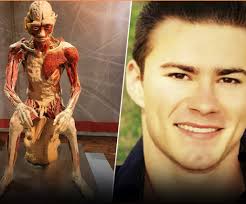 Mother finds son's body in anatomy exhibit