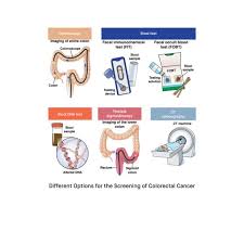 Image result for Colon Cancer Screening with Colonoscopy