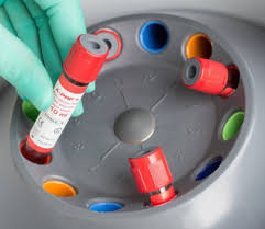 Process for prf is a system designed by the creator of prf technology dr. Prf Protokoll Zahnarztliches Zentrum Stimac