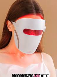 How to Choose Your RED LIGHT LED Mask I Review of the Lumamask Pro  #redlighttherapy #YOUNGERSKIN #holisticskincare #holisticantiaging  #ledlighttherapy #foryoupage #ledmask #ledlightmask #productreview ...