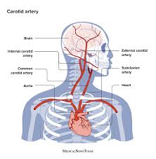 Image result for carotid artery