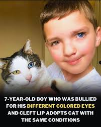 💙 Born to Stand Out — Not to Fit In 💙 Seven-year-old Madden Humphreys  from Oklahoma was born with a bilateral cleft lip and palate and complete  heterochromia — two different colored