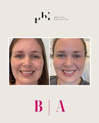 I believe women deserve to be celebrated every single day — not just