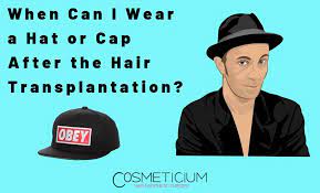 When Can I Wear A Hat Or Cap After The Hair Transplantation