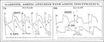 The Sphygmograph In America Writing The Pulse Sciencedirect