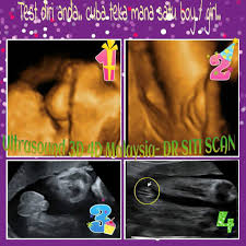 Bagaimana cara mengetahui mental kita sedang terganggu? Baby Boy Or Girl Ultrasound Scan Baby Malaysia Dr Siti Scan
