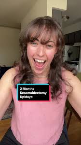 2 Month Sesamoidectomy update! I’m seeing more and more progress everyday!  Can’t wait until I’m back to walking and running outside! #sesamoidbone  #sesamoid #sesamoidectomy #postop #recovery ...