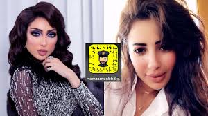 قبل وبعد للمغنية دنيا بطمة. Ø§Ù†ØªÙ‚Ù„ Ø¥Ù„Ù‰ Ø§Ù„Ø¯Ø§Ø¦Ø±Ø© Ø¯Ù„Ùˆ ÙŠØ­ÙˆÙ… Ø³ÙƒÙŠÙ†Ø© ÙƒÙ„Ø§Ù…ÙˆØ± Ù‚Ø¨Ù„ ÙˆØ¨Ø¹Ø¯ Guillotinpoilvet Com