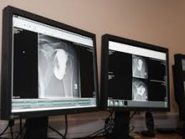 Bienvenue sur imedso le site internet du centre d'imagerie médicale de blendecques et d'aire sur la lys une équipe de professionnels composée de 5 radiologues vous accueille tous les jours du lundi au samedi midi. Dr Provost Martine Imedso