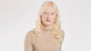 Ich hatte ein problem damit, groß zu sein. Gntm 2021 Sara Leaves Germany S Next Top Model Voluntarily De24 News English