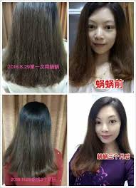 Before And After Biotin Shampoo For Hair Growth Extensive Hair Loss Causes Shampoo Hair Fall Hair Loss Hair Loss Causes