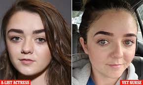 Nurse asked daily if she is the famous Game of Thrones actress who plays  Arya Stark