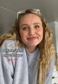 Effective Solutions for Jaw Clenching and Teeth Grinding