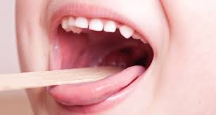 Swollen right tonsil, ear feels blocked. What S Behind Frequent Strep Throat Consult The Tonsils Science News For Students
