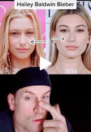 Justin and Hailey Bieber Threaten to Sue a Plastic Surgeon for Saying  Hailey Got Work Done — Scandalous Media