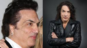 Paul Stanley recalls when he was called “One-eared monster” due to  malformation