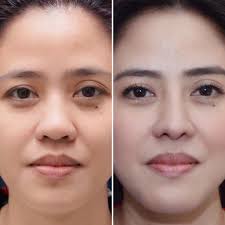 Vicki Belo, M.D. added a new photo.