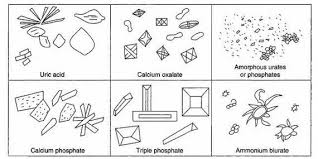Urine Crystals Forms Medical Laboratories Medical Laboratory Medical Laboratory Technician Medical Laboratory Scientist