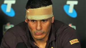 Dazed Hodges refuses to shake Sims' hand