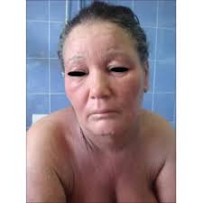 Letter to the Editor