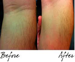Also be sure to keep the cream on for the designated time, but not any longer. How Do Depilatory Creams Work Product Review Olay Facial Hair Removal Duo Futurederm
