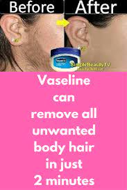 Vaseline Can Remove All Unwanted Body Hair In Just 2 Minutes Today I Will Tell You How Can You Use Vaseline To Unwanted Hair Removal Unwanted Hair Hair Health