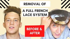 How to Clean a Lace Front Non-Surgical Hair Replacement System with Phil  Osmond UK/USA/International