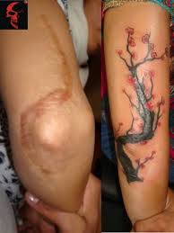 Mole Birthmark Tattoo Cover Up Pin On Tatouages Cicatrices