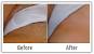 Laser Hair Removal Before And After