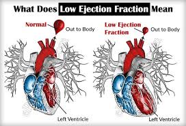Pin On Chest Pain