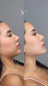 Galier 🏛️ Armonización Orofacial (@galier__) • Instagram photos and videos
