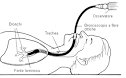 Broncoscopia biopsia