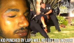 Ronald Weekley Jr. will not get his day in court. A L.A. jury unanimously  rejected his lawsuit against LAPD even though there is video of the  skateboarder getting punched in the face.