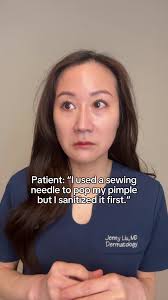 Audrey Tillinger Acne