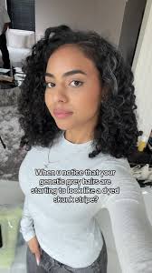 Embracing Premature Grey Hair: Love the Unique Skunk Stripe Look