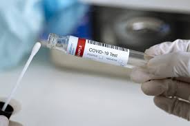 Coronavirus test results can take weeks. For The Fits Coronavirus And Sports Cardiology Understanding Implications From The Individual Athlete To The Olympic Games American College Of Cardiology