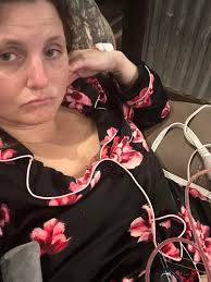 How long does the pain last after explant and capsulectomy and what to take  for detox?