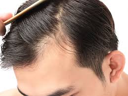 But your hair that returns may be different than before. No Hair Loss During Chemotherapy The Toronto Hair Transplant Clinic