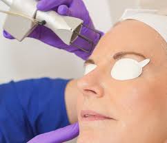 Image result for Laser Skin Procedure