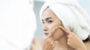 Elakkan menyentuh muka dengan terlalu kerap dan pastikan tangan bersih dahulu. 5 Penyebab Jerawat Sering Timbul Di Pipi Kumparan Com