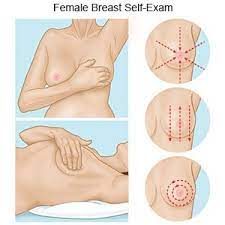 The doctor will ask you questions about your health and will do a physical exam. Breast Cancer In Women Discharge Care What You Need To Know