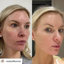 Scott Kelly (@south_texas_cynosurelutronic) • Instagram photos and videos