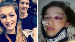 A 13-year-old was dragged into a road and knocked unconscious after her bag  got caught