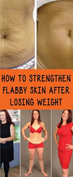 Pin On Weight Loss Remedies