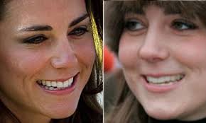 Kate Middleton Was Gangly And Wore A Brace But A 100Mph Kind Of Girl' |  Daily Mail Online
