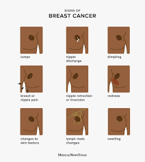 Hier sollte eine beschreibung angezeigt werden, diese seite lässt dies jedoch nicht zu. Breast Cancer Symptoms Early Signs Pictures And More