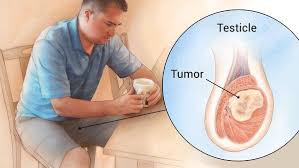 If they ever feel different in size or shape or have lumps, go see the doctor! What Are The Symptoms Of Testicular Cancer Quora