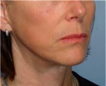 Mariam Awada, MD, FACS