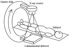 (image courtesy of ge medical systems.) Comparison Of Flat Panel Detector And Image Intensifier Detector For Cone Beam Ct Sciencedirect