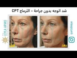 عمليات تجميل الوجه الأخصائية الدكتورة ليلى آرفاس